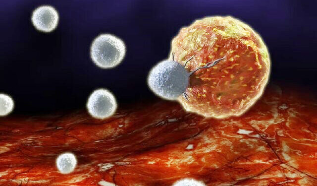 مبارزه با سرطان با کاشت اسفنج در کنار تومور!