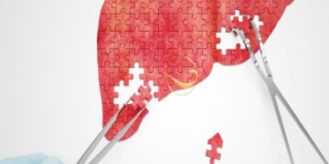 نجات جان 50 نفر از بیماران در هرمزگان توسط اهداکنندگان عضو